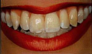 Cosmetic Before Gigapixel