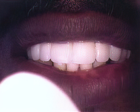 Reconstructive After Gigapixel